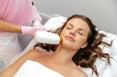Can Laser Hair Removal Work on Chin Hairs?