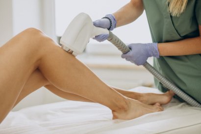 Myths About Laser Hair Removal
