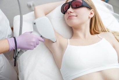 6 Reasons to Switch to Laser Hair Removal Over Waxing