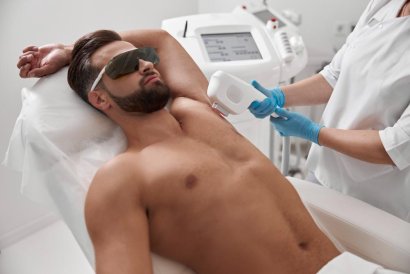 Why Should Men Consider Laser Hair Removal?