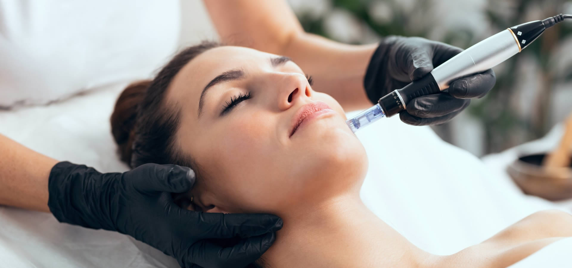 Microneedling